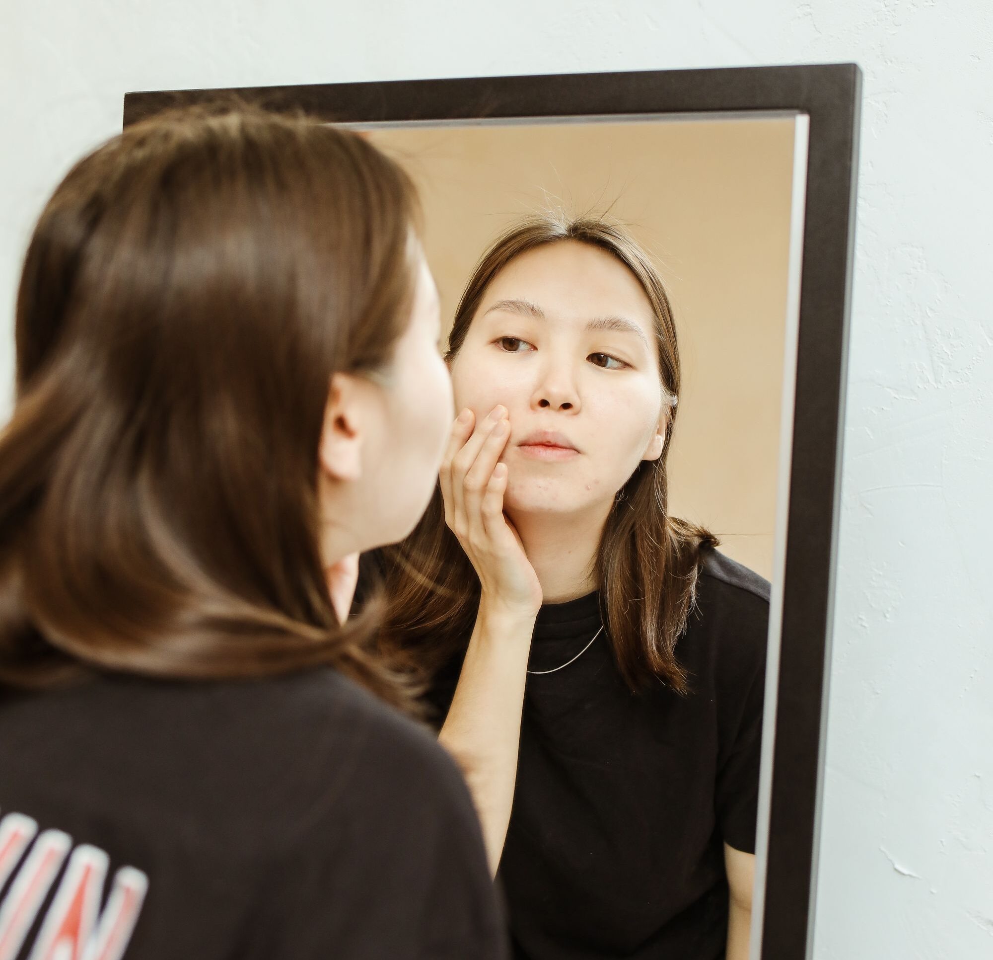 college skincare essentials - acne prevention and treatment